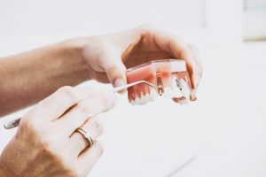 Orthodontist Glasgow holding model teeth and demonstrating a denture being placed into gum